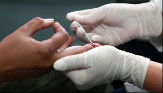 Teste rápido de HIV