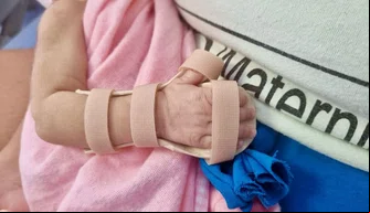 Nova Maternidade Dona Evangelina Rosa produz órteses para prematuros